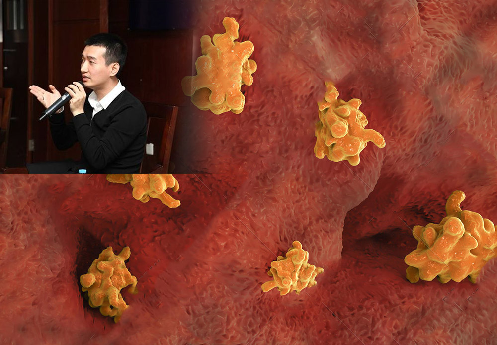 หมดความทุกข์ทรมาณกับโรคพยาธิด้วย Еxtera